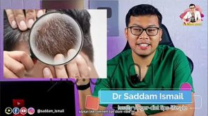 Usia Muda Sudah Timbul Uban di Kepala, Ini Penjelasannya Menurut dr. Saddam Ismail